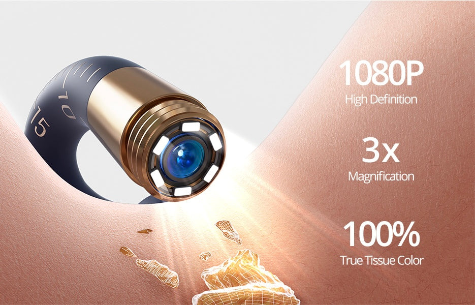 bebird Pro™ – Limpieza de Oídos con Cámara HD en Tiempo Real