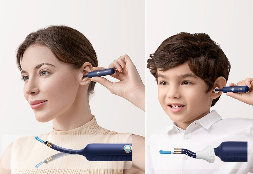 bebird Pro™ – Limpieza de Oídos con Cámara HD en Tiempo Real