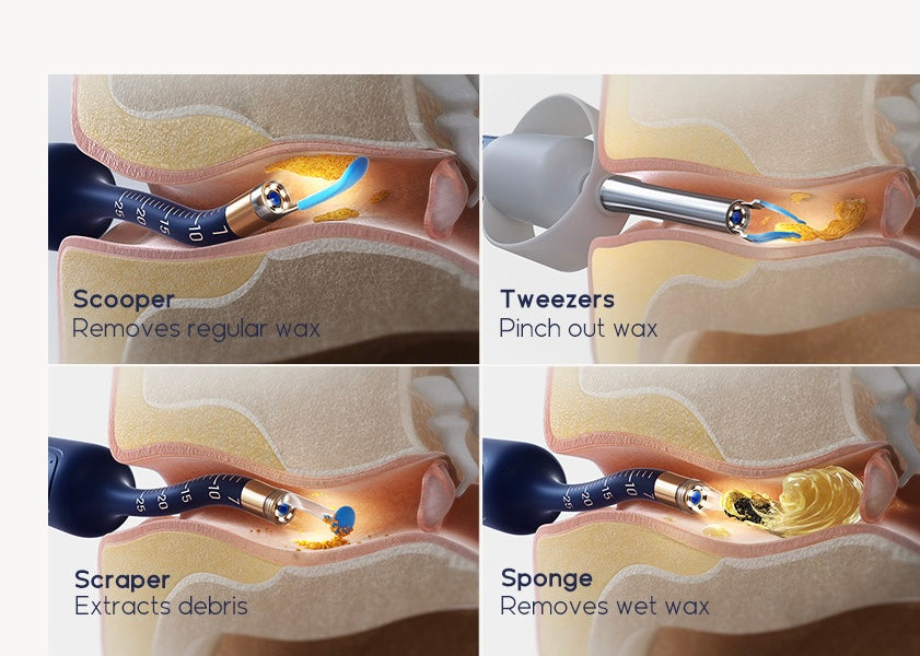 bebird Pro™ – Limpieza de Oídos con Cámara HD en Tiempo Real