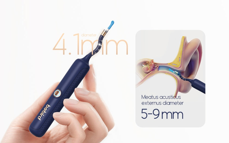 bebird Pro™ – Limpieza de Oídos con Cámara HD en Tiempo Real